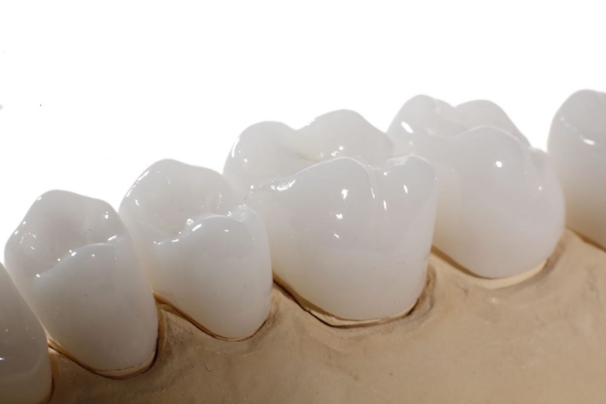 RĂNG SỨ ZIRCONIA