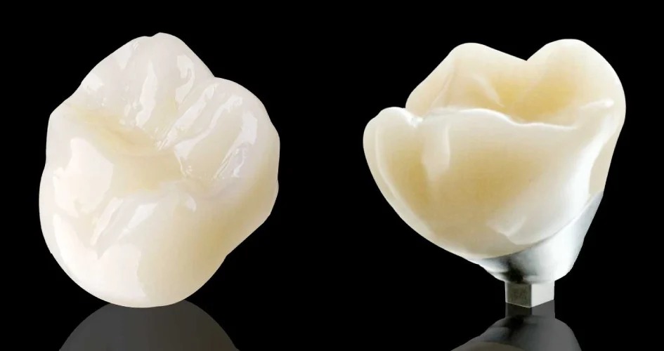 RĂNG SỨ LAVA PLUS
