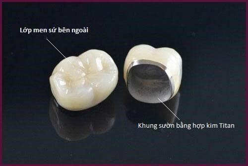 RĂNG SỨ TITAN